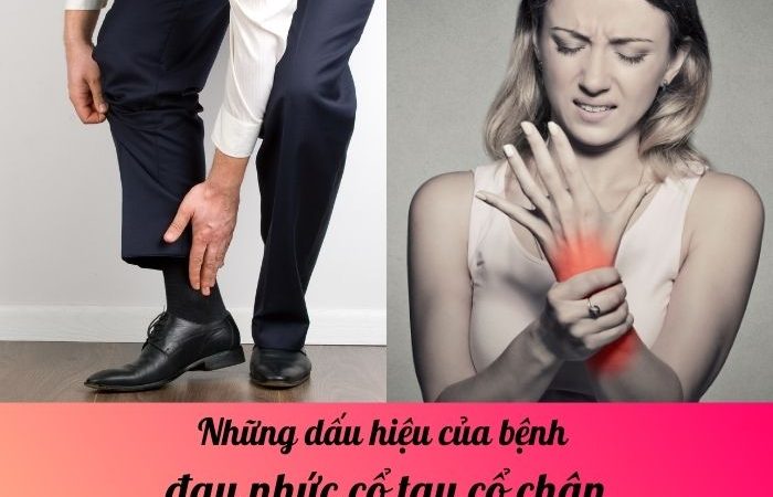 Những dấu hiệu của bệnh đau nhức cổ tay cổ chân